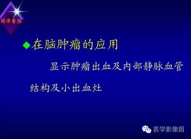 【PPT】MR磁敏感成像SWI原理及其在脑部的应用