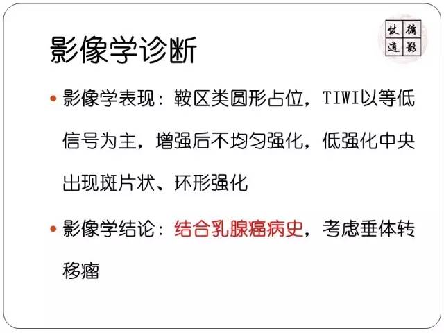 【病例】垂体转移瘤1例MR影像表现
