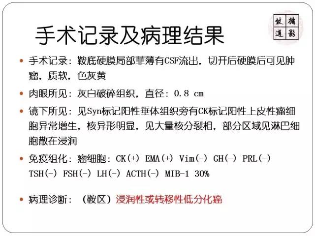 【病例】垂体转移瘤1例MR影像表现