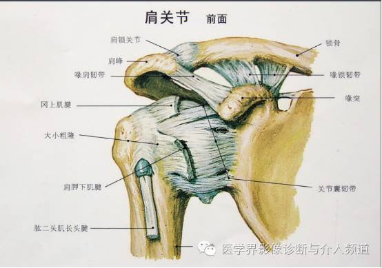 【病例】钙化性冈上肌腱炎1例X线MR影像表现 【病例】钙化性冈上肌腱炎1例X线MR影像表现