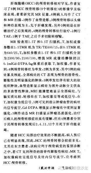 【病例】颅骨转移瘤1例CT及MR影像表现
