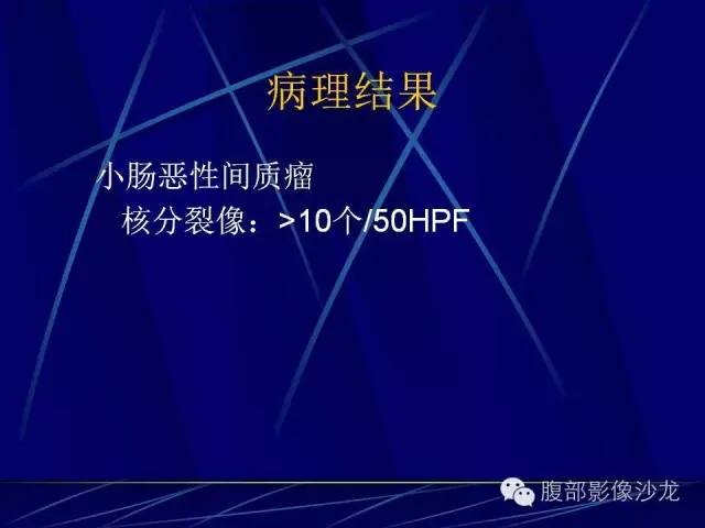 【病例】胃肠道间质瘤1例CT影像表现 【病例】胃肠道间质瘤1例CT影像表现