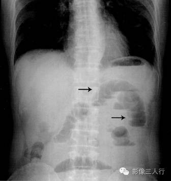 自动草稿