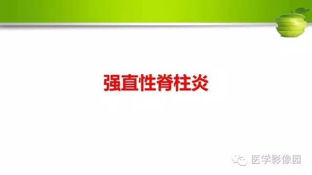 强直性脊柱炎
