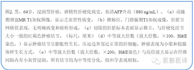 浸润性肝癌的影像学诊断和鉴别诊断