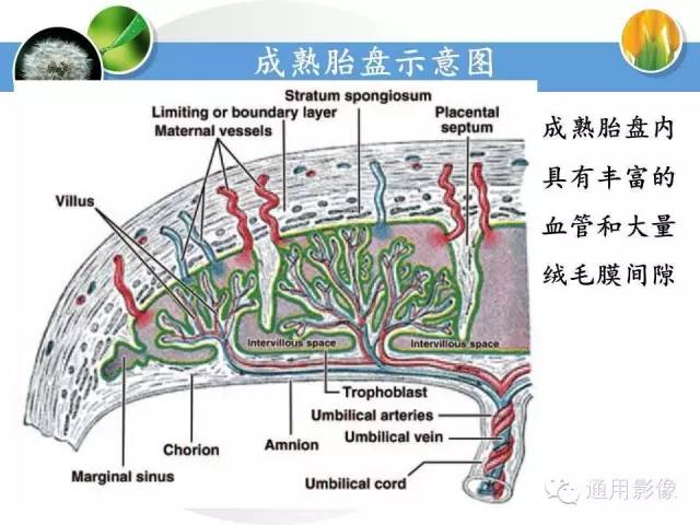 【PPT】异常妊娠的MRI表现
