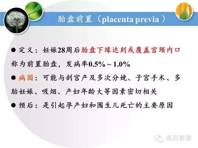 【PPT】异常妊娠的MRI表现