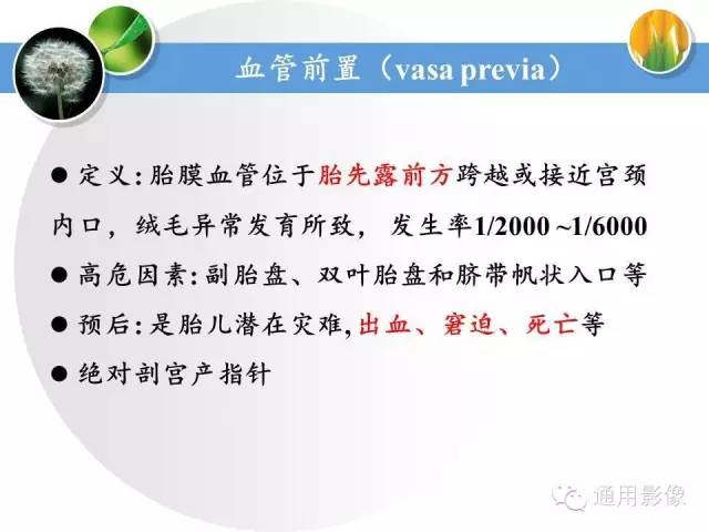 【PPT】异常妊娠的MRI表现