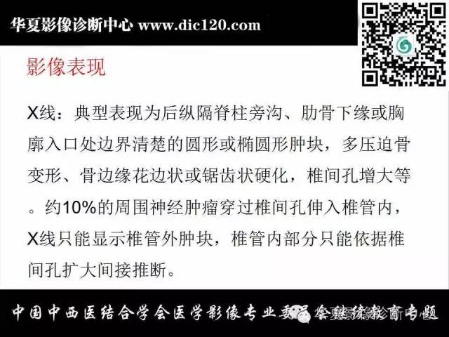 【PPT】胸壁常见病变影像诊断