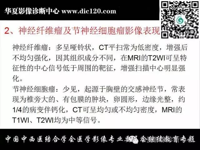 【PPT】胸壁常见病变影像诊断