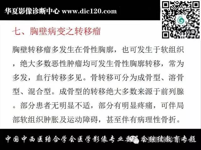 【PPT】胸壁常见病变影像诊断