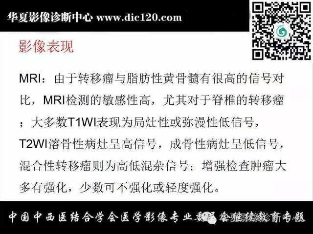 【PPT】胸壁常见病变影像诊断