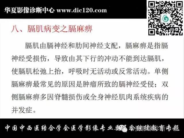 【PPT】胸壁常见病变影像诊断