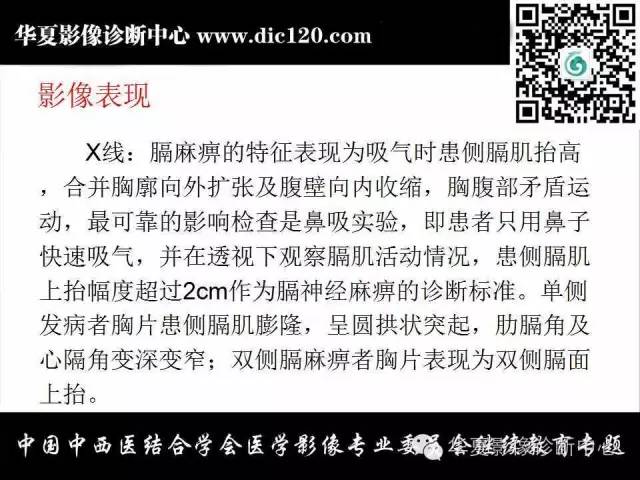 【PPT】胸壁常见病变影像诊断