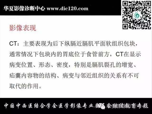 【PPT】胸壁常见病变影像诊断
