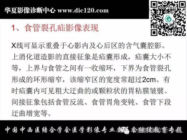 【PPT】胸壁常见病变影像诊断
