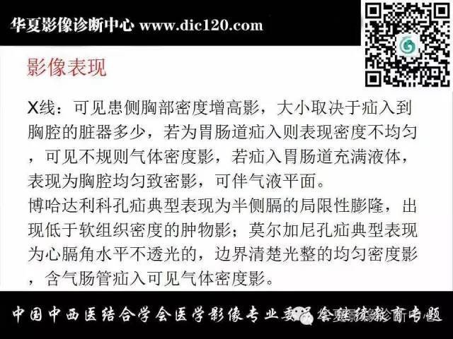 【PPT】胸壁常见病变影像诊断