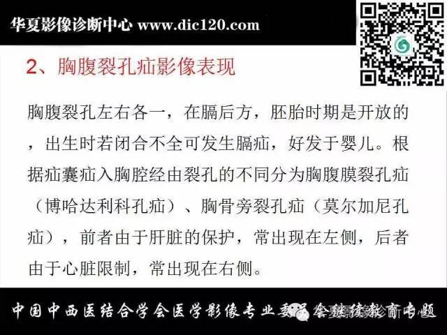 【PPT】胸壁常见病变影像诊断