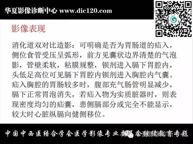 【PPT】胸壁常见病变影像诊断