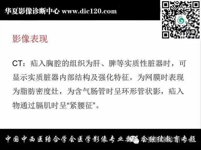【PPT】胸壁常见病变影像诊断