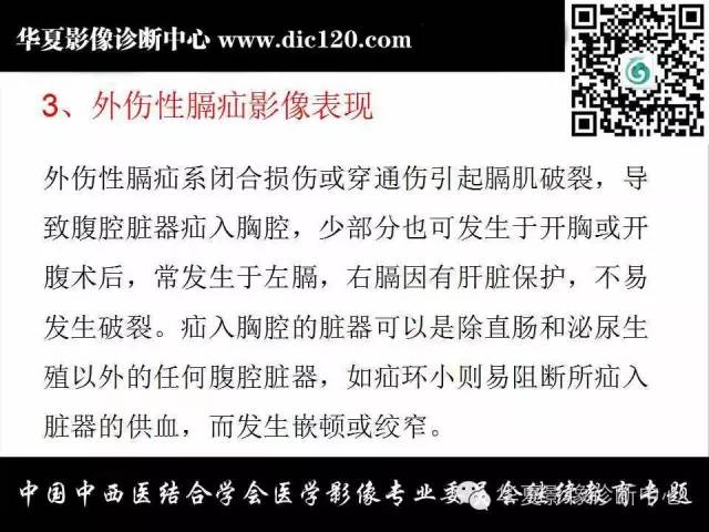 【PPT】胸壁常见病变影像诊断