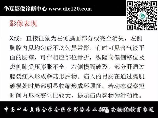 【PPT】胸壁常见病变影像诊断
