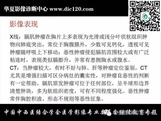 【PPT】胸壁常见病变影像诊断