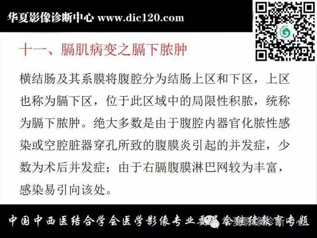 【PPT】胸壁常见病变影像诊断