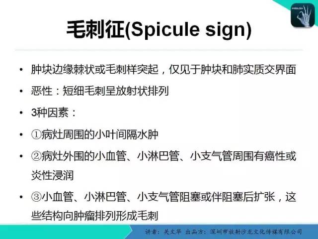 【PPT】孤立性肺结节的影像学诊断