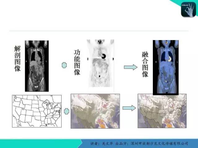 【PPT】孤立性肺结节的影像学诊断