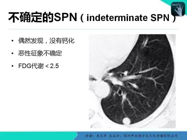 【PPT】孤立性肺结节的影像学诊断