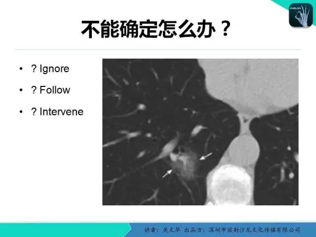 【PPT】孤立性肺结节的影像学诊断