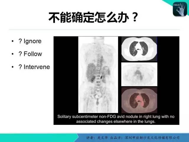 【PPT】孤立性肺结节的影像学诊断