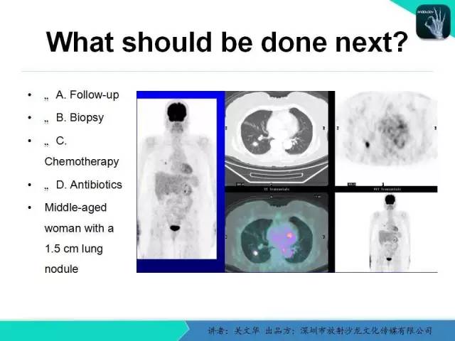 【PPT】孤立性肺结节的影像学诊断