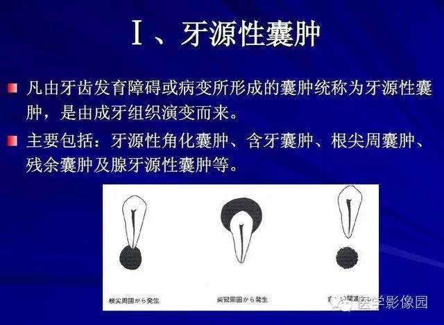 【PPT】常见颌骨囊肿与肿瘤的影像学表现