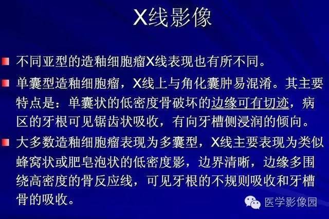 【PPT】常见颌骨囊肿与肿瘤的影像学表现