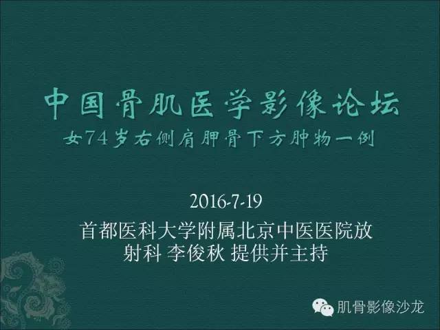【病例】胸壁弹力纤维瘤1例MR影像表现