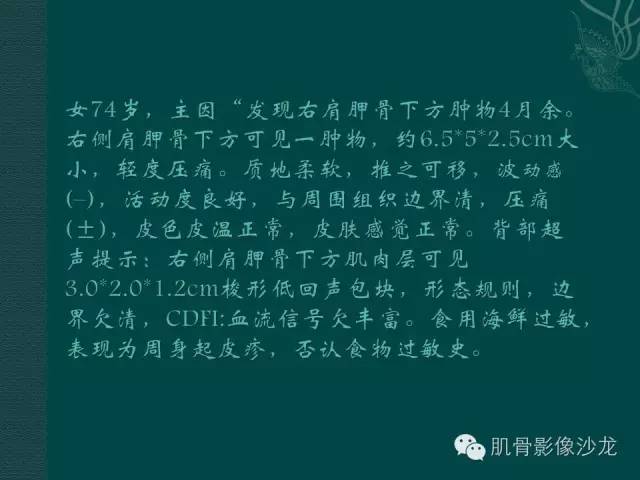 【病例】胸壁弹力纤维瘤1例MR影像表现