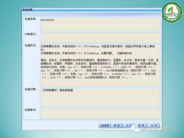 【病例】腹膜后嗜铬细胞瘤1例