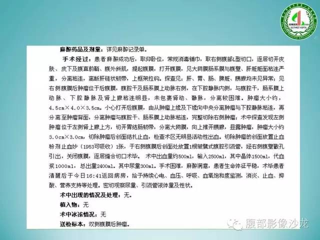 【病例】腹膜后嗜铬细胞瘤1例