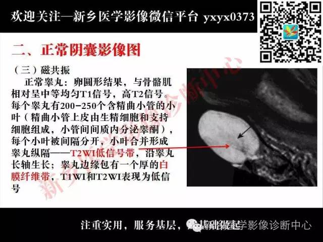 【PPT】阴囊病变影像诊断