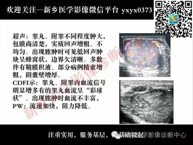 【PPT】阴囊病变影像诊断
