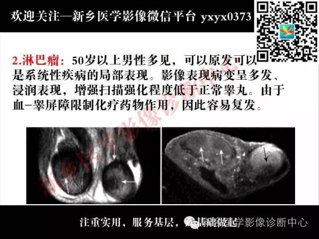【PPT】阴囊病变影像诊断
