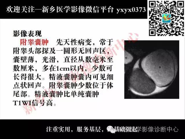 【PPT】阴囊病变影像诊断