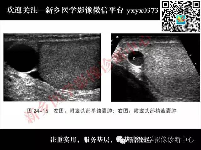 【PPT】阴囊病变影像诊断