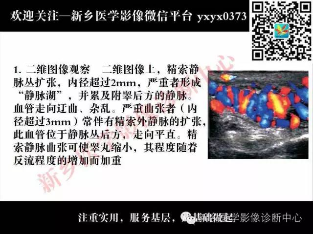 【PPT】阴囊病变影像诊断
