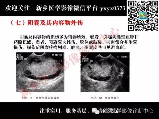 【PPT】阴囊病变影像诊断