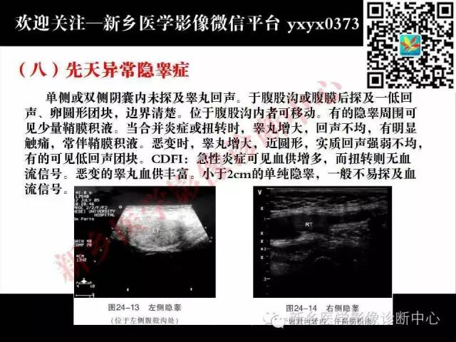 【PPT】阴囊病变影像诊断