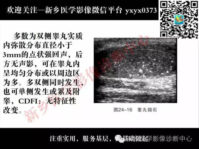 【PPT】阴囊病变影像诊断