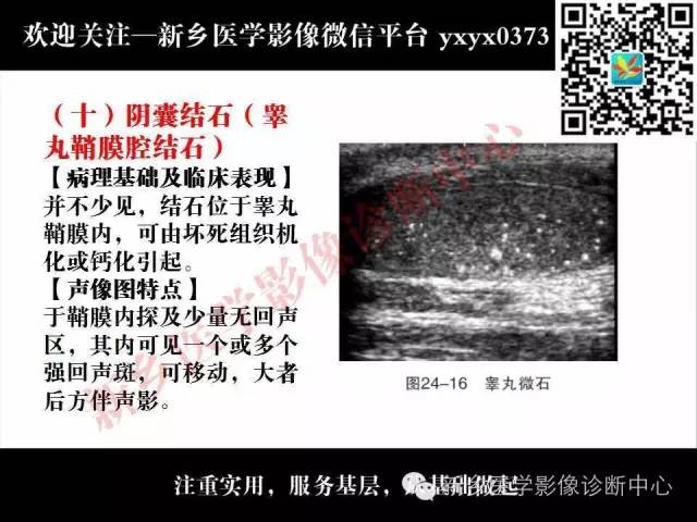 【PPT】阴囊病变影像诊断